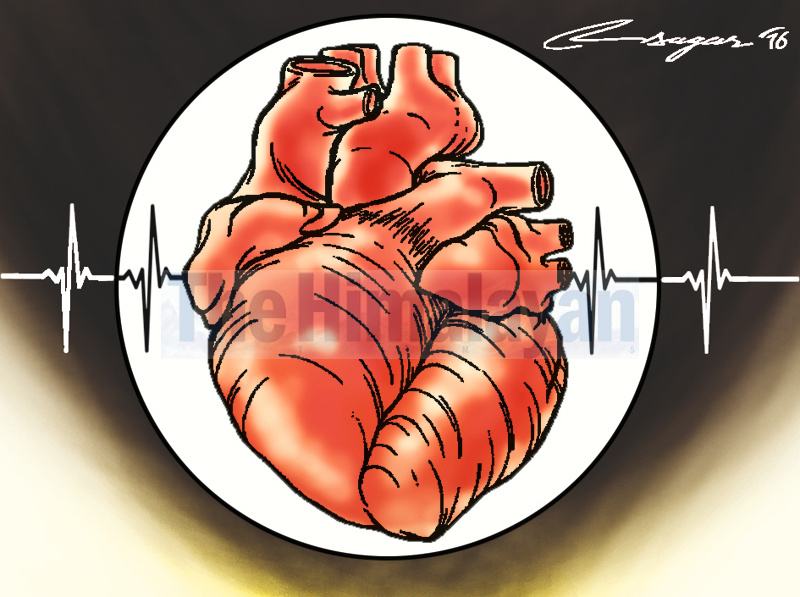 50 heart patients benefit from RFA procedure
