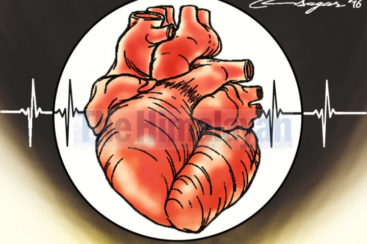 50 heart patients benefit from RFA procedure